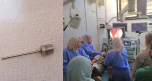 عملية ناجحة لاستخراج مسمار من معدة طفل أنقذ فريق طبي متخصص بقسم علاج أمراض الجهاز الهضمي والكبد والمناظير بالمستشفى الجامعي طرابلس، صباح اليوم الأربعاء ،حياة طفل يبلغ من العمر 11 عامًا، بعد ابتلاعه مسمار نفخ إطارات السيارات. وأوضح المكتب الاعلامي في المستشفى بأن حالة الطفل استدعت تدخلاً فوريًا، حيث قرر الأطباء إجراء عملية منظار علوي دقيقة وعاجلة لاستخراج المسمار من الإثنى عشر، وسط ظروف دقيقة تتطلب دقة وسرعة استجابة. أُجريت العملية تحت التخدير الكامل و استمرت 30 دقيقة، وتكللت بالنجاح دون تسجيل أي مضاعفات، حيث نُقل الطفل بعدها إلى القسم لمتابعته من قبل الفريق الطبي، قبل منحه إذن مغادرة بعد استقرار حالته الصحية.