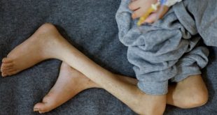 اطفال غزة ضحايا سوء التغذية الناتج عن الحصار الصهيوني