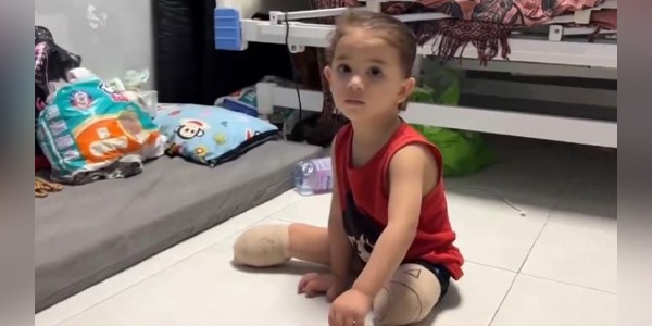 أطفال غزة مبتورو الأطراف…ضحايا الحرب المنسيّون في ردهات الألم