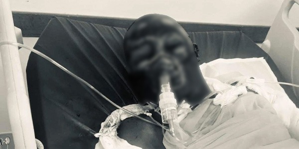 تسجيل وفاة الحالة السابعة جراء حريق "مخيم تاورغاء"