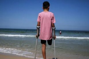 الصحة العالمية: 5 آلاف فلسطيني تم بتر أطرافهم منذ بدء الحرب