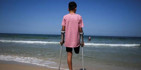 الصحة العالمية: 5 آلاف فلسطيني تم بتر أطرافهم منذ بدء الحرب