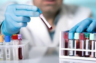 أزمة نقص المشغلات… على المحك