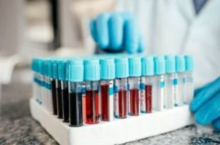 بعد سن الأربعين.. أربعة فحوصات دم تنقذ حياتك