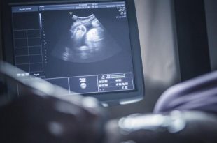 تلوث الهواء يبطئ نمو دماغ الأطفال حديثي الولادة!