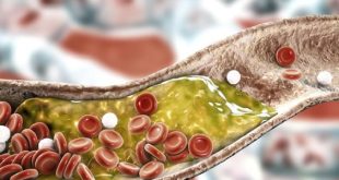 نتائج مذهلة خلال 30 يوما.. نظام غذائي يخفض الكوليسترول كما تفعل الأدوية