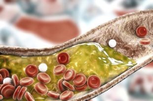 نتائج مذهلة خلال 30 يوما.. نظام غذائي يخفض الكوليسترول كما تفعل الأدوية