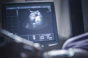 طفرة بحثية تكشف دور عمر الأم في توقف تطور الأجنة