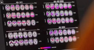 دراسة: الاستماع للموسيقى بعد السبعين يخفض خطر الخرف بـ40 %