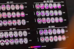 دراسة: الاستماع للموسيقى بعد السبعين يخفض خطر الخرف بـ40 %