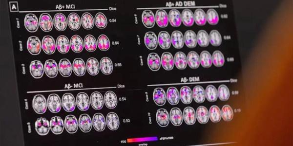 دراسة: الاستماع للموسيقى بعد السبعين يخفض خطر الخرف بـ40 %