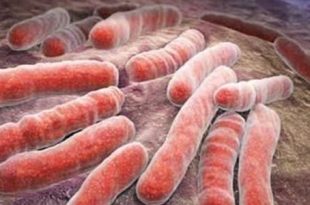 السل يتصدر الأمراض الفتّاكة و2000 مريض يتلقون استشارات في ليبيا