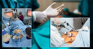 عمليات تكميم المعدة .. علاج أم "موضة باهضة"؟