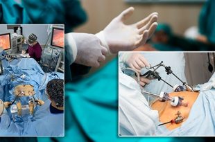 عمليات تكميم المعدة .. علاج أم "موضة باهضة"؟