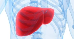 دراسة تكشف أن الكبد الدهني غير الكحولي يضاعف خطر الوفاة المبكرة