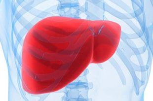 دراسة تكشف أن الكبد الدهني غير الكحولي يضاعف خطر الوفاة المبكرة