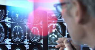 دواء لألزهايمر يحقق نتائج غير مسبوق ويُبطئ تطور المرض