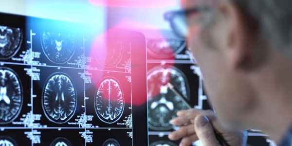 دواء لألزهايمر يحقق نتائج غير مسبوق ويُبطئ تطور المرض