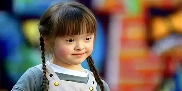 تقنية حديثة تنجح في فصل مُتسبب متلازمة "داون"