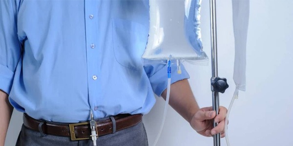 «غسيل الكلى البريتوني» يحافظ على القدرات الذهنية لمرضى الفشل الكلوي