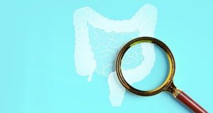 اكتشاف علاقة بين أدوية الكوليسترول وسرطان القولون