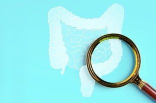 اكتشاف علاقة بين أدوية الكوليسترول وسرطان القولون