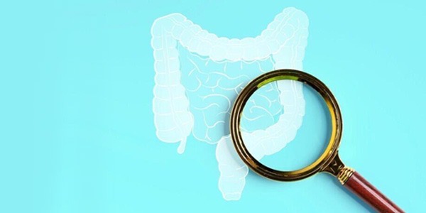 اكتشاف علاقة بين أدوية الكوليسترول وسرطان القولون