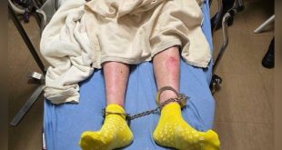 احتجاز ليبي مريض بمرض جلدي نادر في مينيسوتا يثير مخاوف إنسانية وطبية