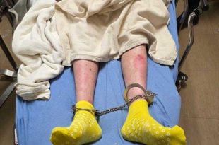 احتجاز ليبي مريض بمرض جلدي نادر في مينيسوتا يثير مخاوف إنسانية وطبية