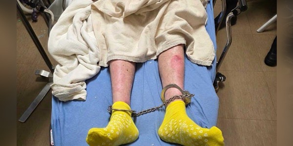 احتجاز ليبي مريض بمرض جلدي نادر في مينيسوتا يثير مخاوف إنسانية وطبية