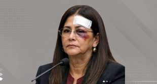 جروح سيليا فلوريس تشعل جدلاً انسانيا وحقوقيا