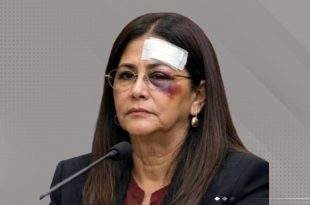 جروح سيليا فلوريس تشعل جدلاً انسانيا وحقوقيا