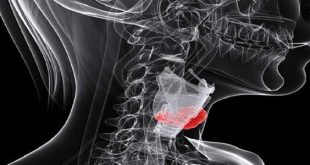 تطوير مركبات نحاسية ذكية تقضي على خلايا سرطان الحنجرة