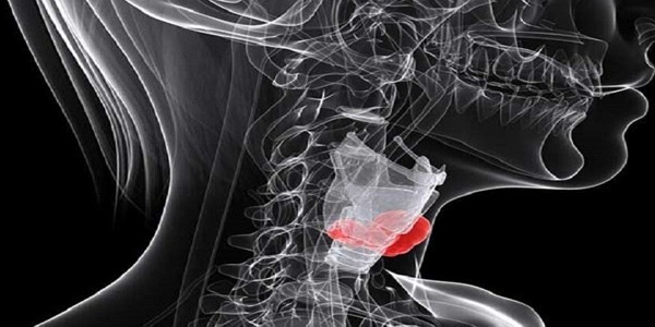 تطوير مركبات نحاسية ذكية تقضي على خلايا سرطان الحنجرة