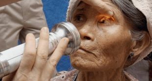 الصحة العالمية: 78 مليون شخص يعانون أمراض مدارية مهملة