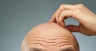 كريم جديد قد يعيد نمو الشعر بنسبة تصل إلى 500% عند الرجال