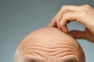 كريم جديد قد يعيد نمو الشعر بنسبة تصل إلى 500% عند الرجال