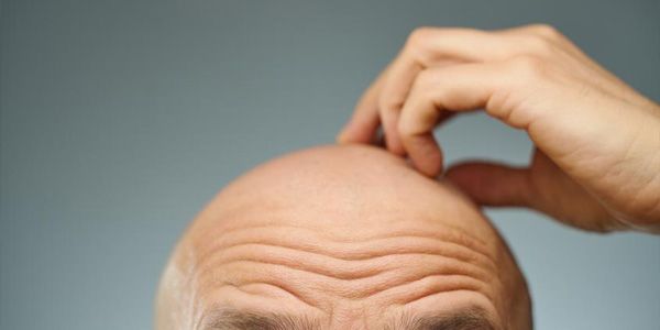 كريم جديد قد يعيد نمو الشعر بنسبة تصل إلى 500% عند الرجال