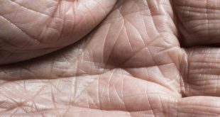 اكتشاف "سحّاب بيولوجي" في الجلد قد ينهي عصر التجاعيد والندوب