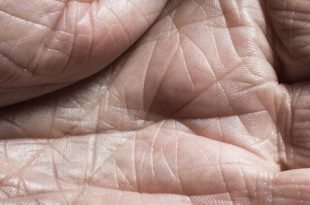 اكتشاف "سحّاب بيولوجي" في الجلد قد ينهي عصر التجاعيد والندوب