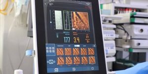 مستشفى الهضبة الخضراء العام يطلق جهاز FibroScan لفحص الكبد بدقة عالية