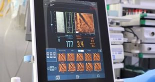 مستشفى الهضبة الخضراء العام يطلق جهاز FibroScan لفحص الكبد بدقة عالية