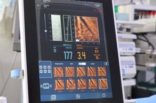 مستشفى الهضبة الخضراء العام يطلق جهاز FibroScan لفحص الكبد بدقة عالية