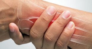 النشاط البدني سلاح فعّال ضد هشاشة العظام