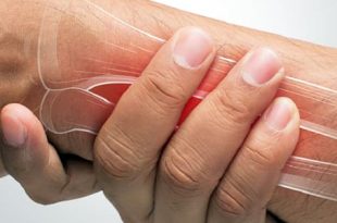 النشاط البدني سلاح فعّال ضد هشاشة العظام