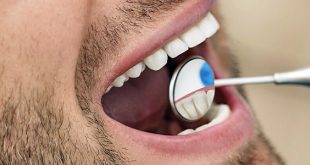 اكتشاف سبب غير متوقع لتدهور صحة الفم والأسنان