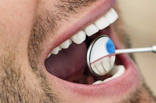 اكتشاف سبب غير متوقع لتدهور صحة الفم والأسنان