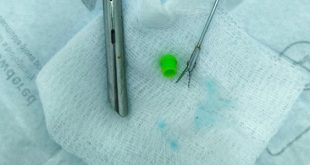 إنقاذ طفل من انسداد رئوي بسبب غطاء قلم بمستشفى الأطفال في بنغازي