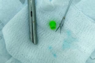 إنقاذ طفل من انسداد رئوي بسبب غطاء قلم بمستشفى الأطفال في بنغازي