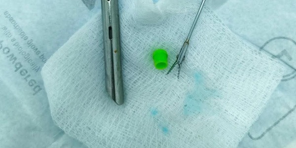 إنقاذ طفل من انسداد رئوي بسبب غطاء قلم بمستشفى الأطفال في بنغازي